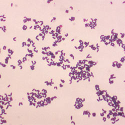 Lapses in Infection Control Responsible for Corynebacterium striatum ...